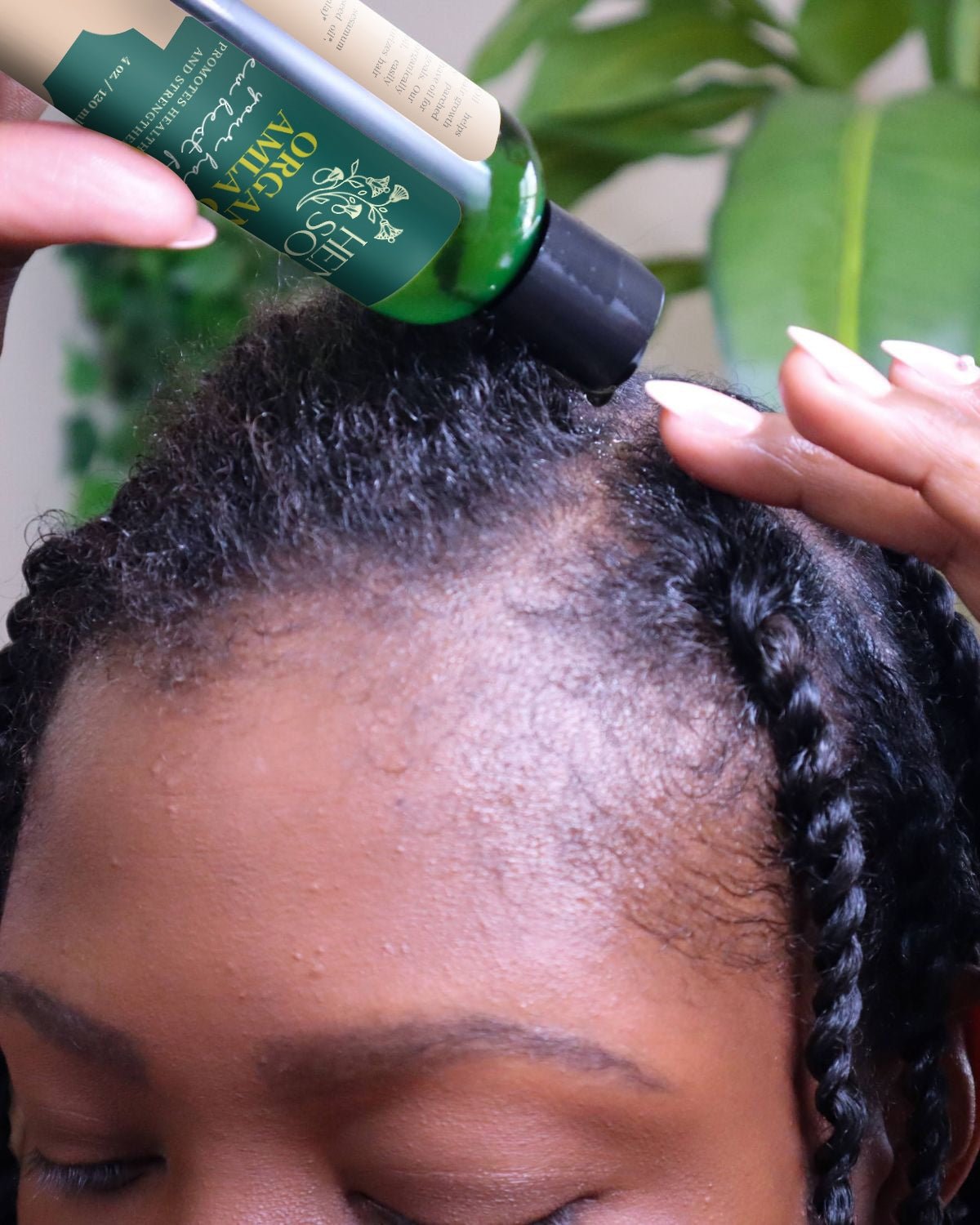 Where the Amla At, Tho? - Using Amla Oil to Promote Hair Growth